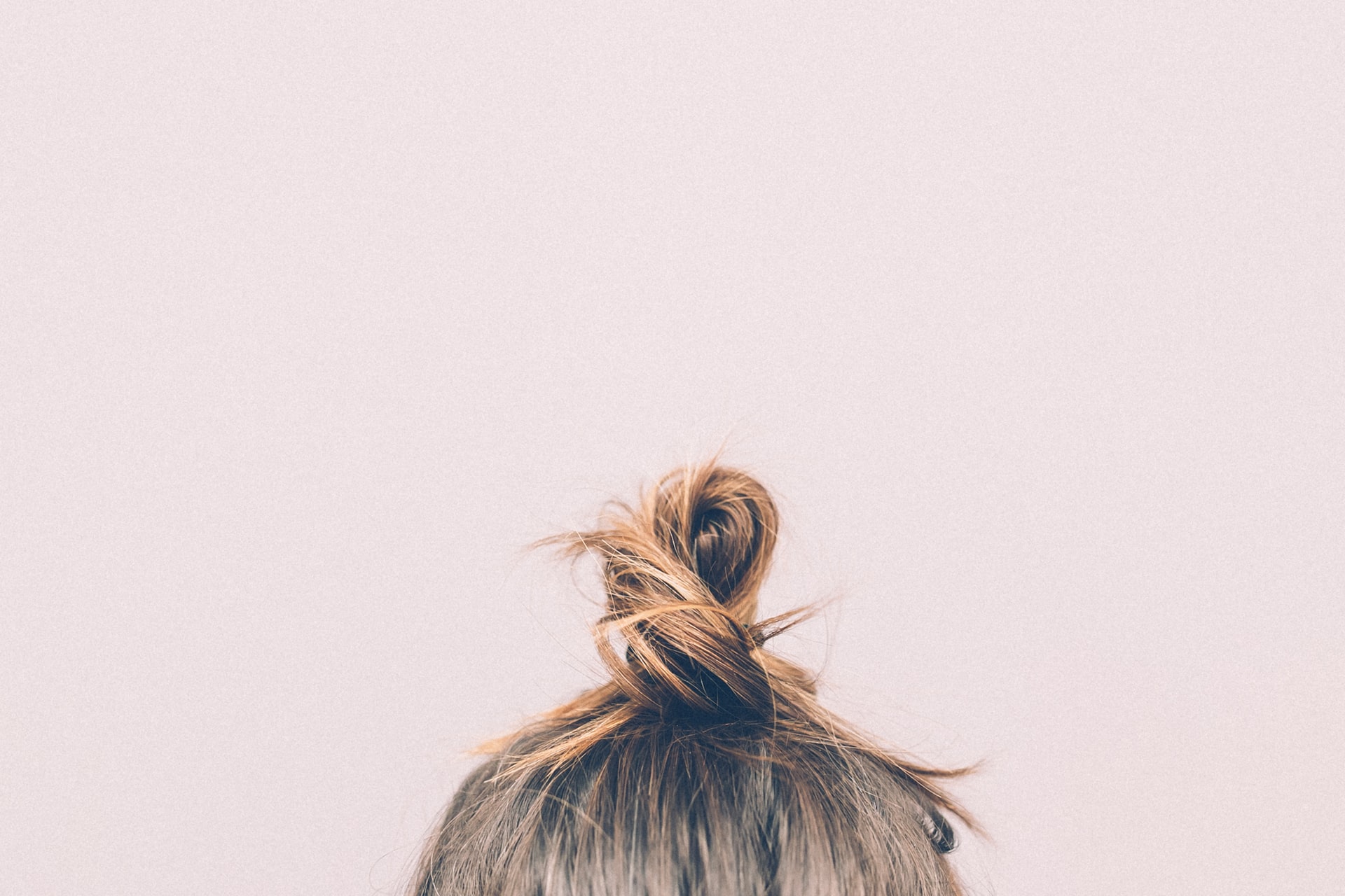 Har du alopecia?